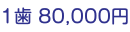 1歯 80,000円